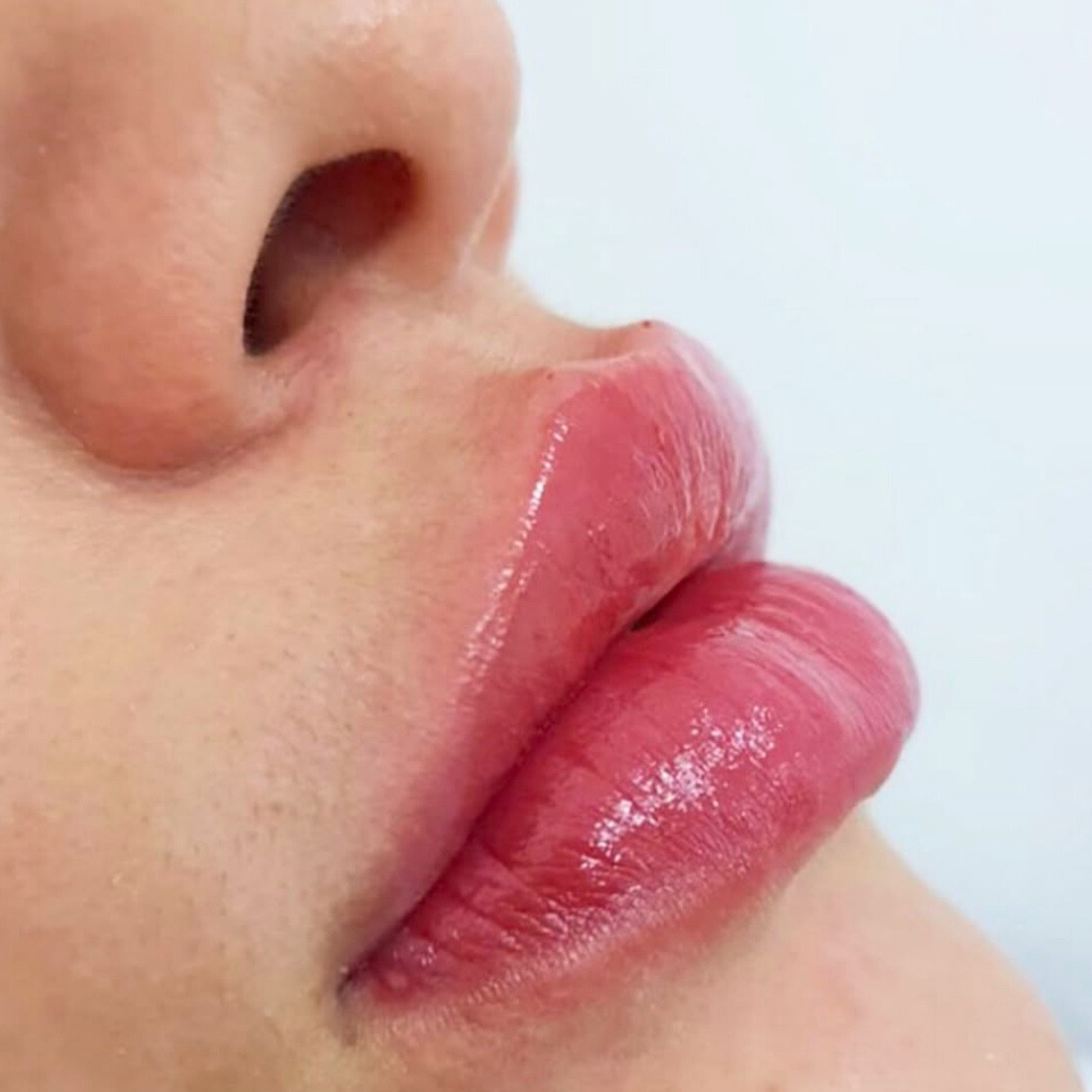 Resultados BAVNA clientes (11)