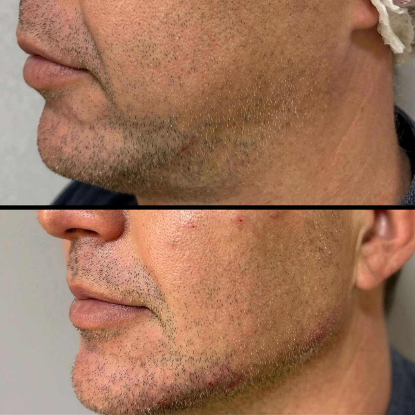 Resultados BAVNA clientes (9)